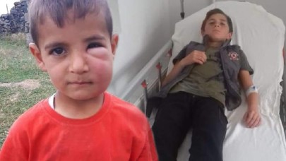 Arıların saldırısına uğrayan 2 çocuk hastaneye kaldırıldı