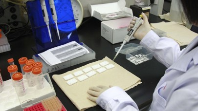 Gen teknolojisiyle HIV virüsü tarih olabilir: Hayvanlar üzerinde başarılı oldu