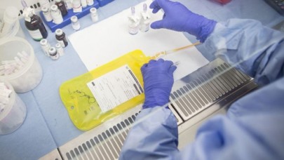 Kanserde tümörlerin zayıf noktası bulundu