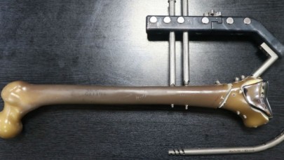 Kırık tedavileri için 'yerli çivi' üretildi