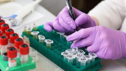 Nöronlardaki kusurlu proteinleri ayıklayan molekül bulundu