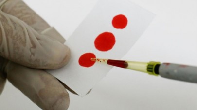 'Türkiye'de 3, 5 milyon kişi hepatit B'