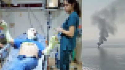 MHP İlçe Başkanı teknede çıkan yangında yaralandı