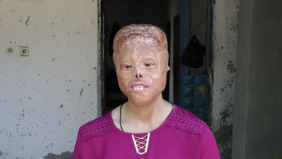 Sağlık Bakanı Koca'dan Leyla'nın tedavi süreciyle ilgili önemli açıklama