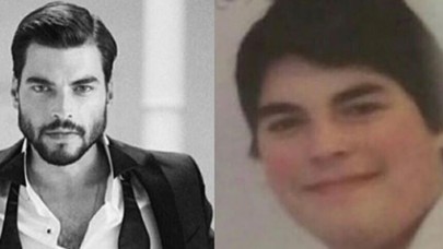 Ünlü Oyuncunun Eski Hali Şaşkına Çevirdi!