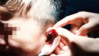 Öğrencisinin Kulağını Zımbaladı!