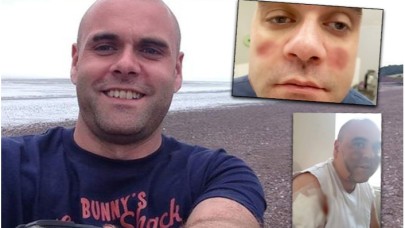 'Yaşayan Zombi'ye Dönüştü!