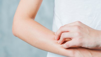 Deri Hastalıklarına Doğal Tedavi!