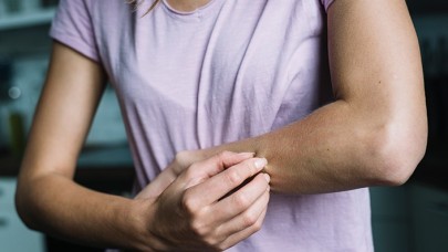 Devamlı Kaşınıyorsanız Size de Bulaşmış Olabilir!