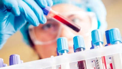 Kanseri Durdurmanın Yolu Bulundu!