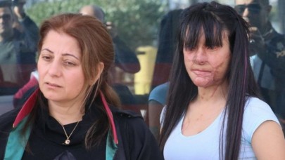 Berfin Özek,  Yüzüne Asit Döken Sanığa Verilen Ceza Hakkında Konuştu: Acılarım 13 Yıla Sığacak mı?