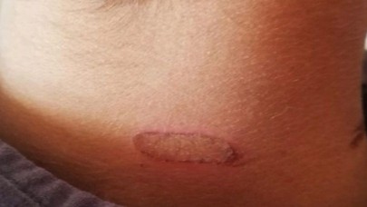 Öğrencilerin Vücuduna Sıcak Soba Izgarası Değdiren Öğretmen Açığa Alındı!