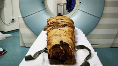 Ölü Bir İnsanın Sesi İlk Kez Bilim Aracılığıyla Hayata Döndürüldü!