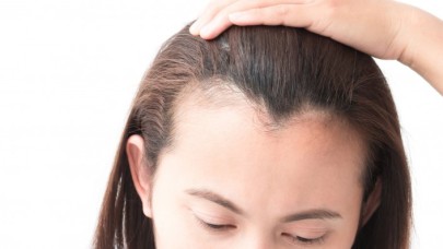 Saç Ekimi Cinselliği Etkiler Mi? Saç Ekimi Sonrası Cinsellik