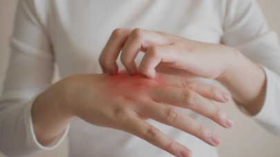 Uzmanından 'Uyuz' Uyarısı: Teknolojik Aletlere Dikkat!