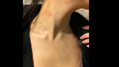 Beşiktaş'ta Otelde Cinsel Saldırı Skandalı!