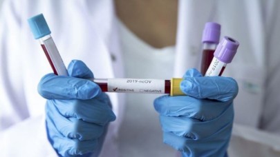 Otelde koronavirüs alarmı: Test pozitif çıkınca 1000 kişi karantina altına alındı!