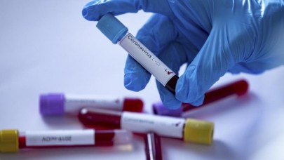 14 gün kuralına uymayan 12 vatandaşa para cezası!