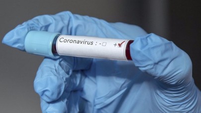 Azerbaycan’da koronavirüs paniği: Eğitime 1 hafta ara verildi!