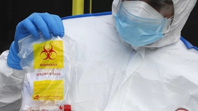 Çin'de koronavirüs testi geliştirildi: 15 dakikada sonuç veriyor