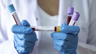 Çin'den getirilen ilaca ilişkin Bilim Kurulu Üyesi: Hastalarda hızlı iyileşmeler olabilir