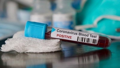 Damadın koronavirüs testi pozitif çıktı! Olayı duyuran kişinin evini bastılar!