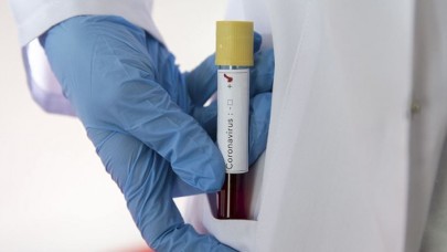 Doğum yaptıktan sonra koronavirüs nedeniyle hayatını kaybetti