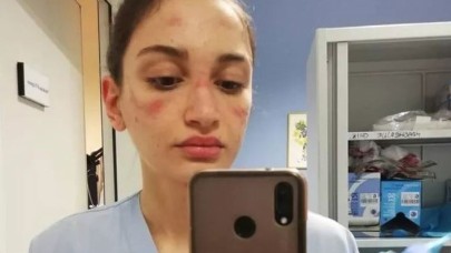 İtalyan hemşirenin yüzü bu hale geldi: "Korkuyorum"