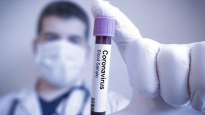 Koronavirüs,  ABD'li bir ilaç firmasının oyunu mu?