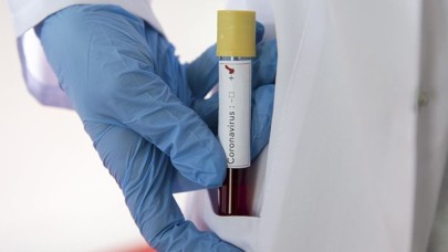 Koronavirüs aşısı geliştiriliyor: Gönüllü olana 800 TL verilecek