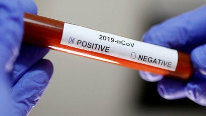 Sağlık Bakanlığı açıkladı: Koronavirüs nedeniyle yıllık izinler iptal edildi!