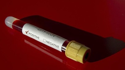 Sağlık Bakanlığı,  koronavirüs testi yaptıranların sonuçlarına ulaşacağı uygulamayı açıkladı!