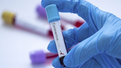 Suudi Arabistan'da koronavirüs alarmı: Hepsi durduruldu!