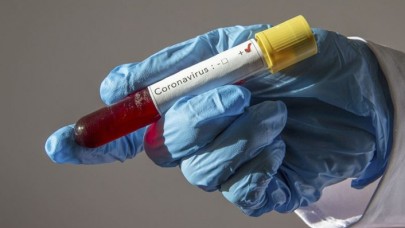 8 günlük bebeğe koronavirüs teşhisi konuldu