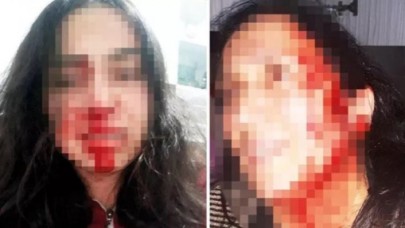 Anne ve kızın yardım çığlıkları: Bizi öldürecek,  sesimizi ölmeden duyun