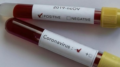 Koronavirüs hastalarını gizleyen muhtar görevden alındı