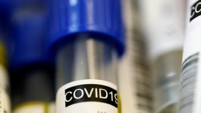 Dolandırıcılar koronavirüs kiti diye hamilelik testi satıyor