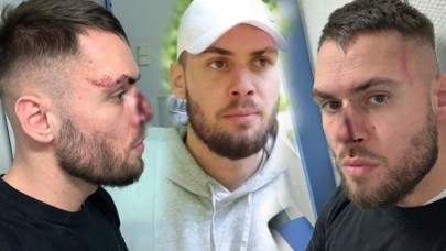 Maske takmadı diye polislerden dayak yedi!