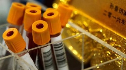 Çin'de yeni virüs tespit edildi! DSÖ'den ilk açıklama geldi