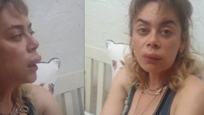 Demet Evgar bu hale nasıl geldi? 