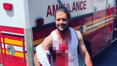 Korku filmi değil gerçek: Kafasına saplanan bıçakla sokağa fırladı