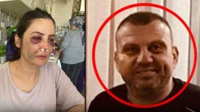 Resmen vahşet:  Erol Elbasan,  eşi Derya Elbasan'a bakın ne yaptı!