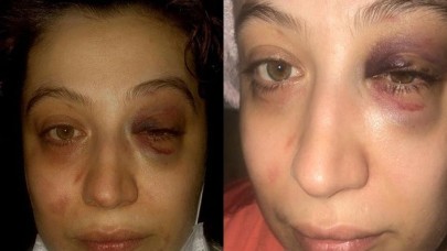 Eşi tarafından darp edildiğini iddia eden kadının yardım çığlığı sosyal medyanın gündemine oturdu!