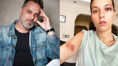 Ozan Güven'in şoförünün ifadesi ortaya çıktı: Olayın tüm seyri değişti!