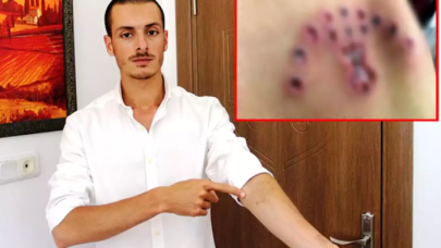 Özel harekatçı olmak için dövmelerini sildirmeye giden gencin hayatı karardı!