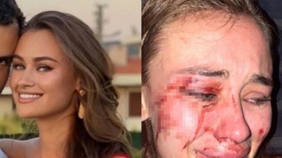 Dünyaca ünlü modele Çeşme'de feci dayak!