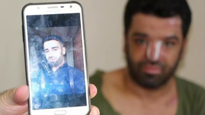 Epilepsi nöbeti sonrası sıcak suya düşen Bilal Cesur eski haline dönmek istiyor