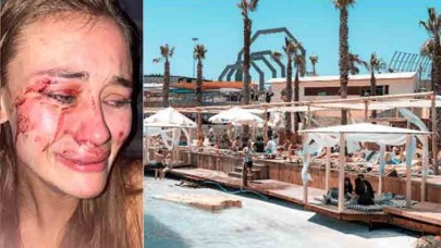 Modele dayak olayında flaş gelişme: Çeşme'deki o mekan kapatıldı