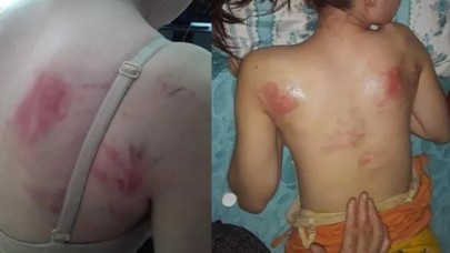 Tekirdağ'da vicdansız adam,  telefon şifresini söylemeyen kızını,  ingiliz anahtarıyla dövdü