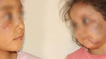 Bu nasıl baba! Çocuklarına 2 gün boyunca işkence yaptı